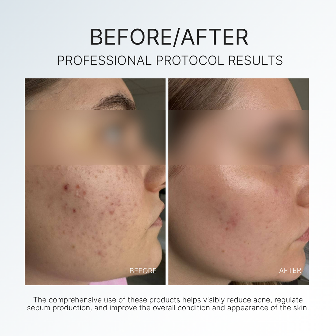 CLEAR SKIN BALANCE