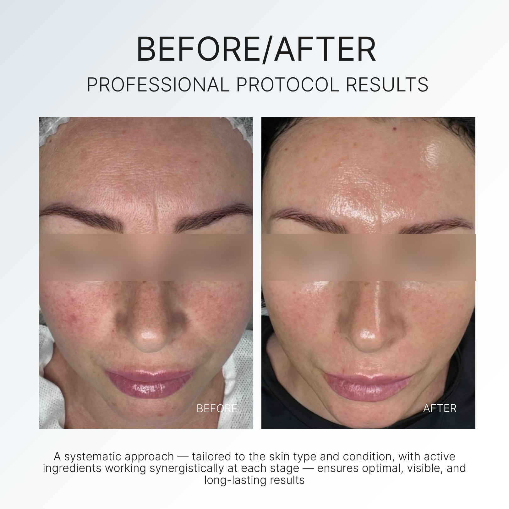PRO-AGE CONTROL DAILY