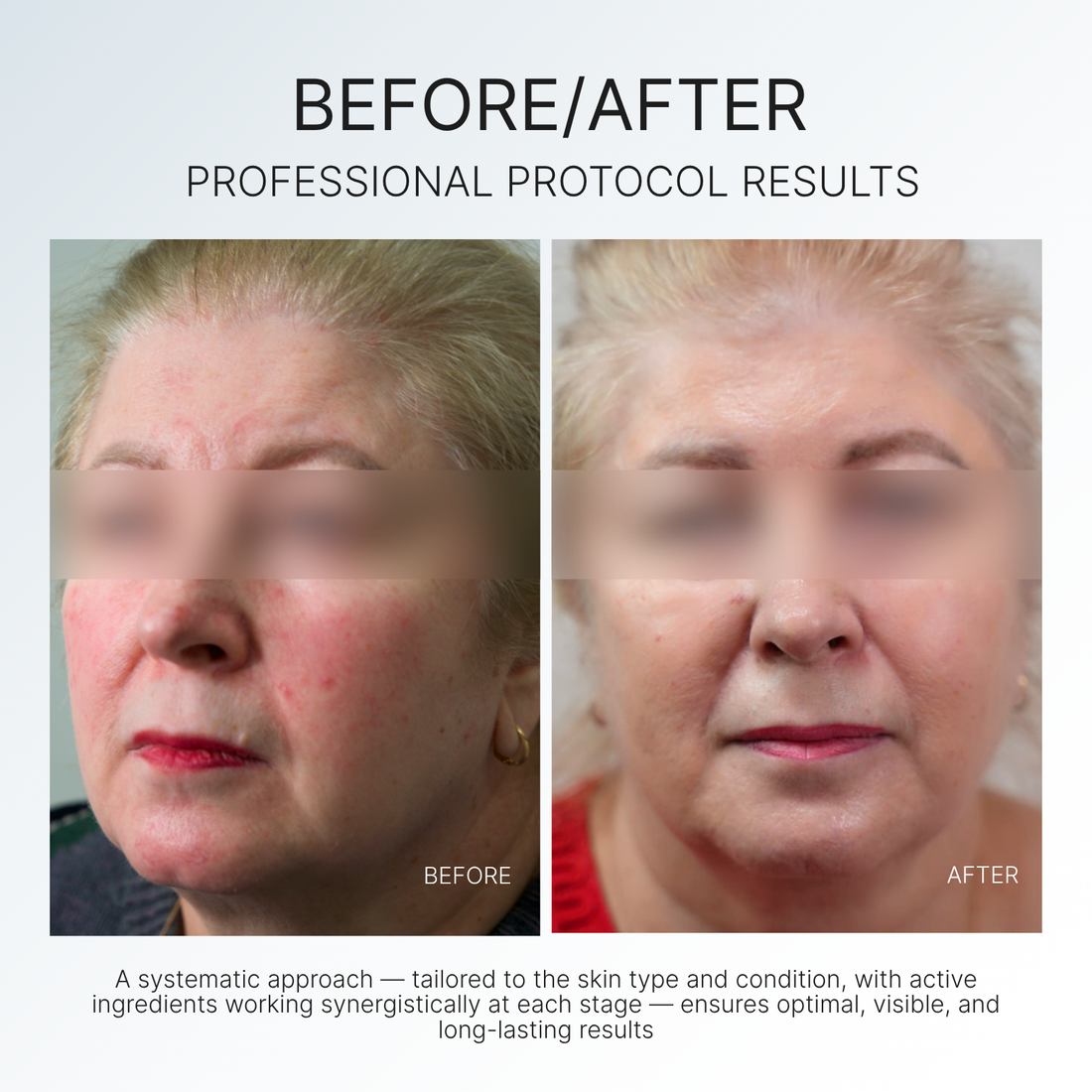PRO-AGE CONTROL INTENSE