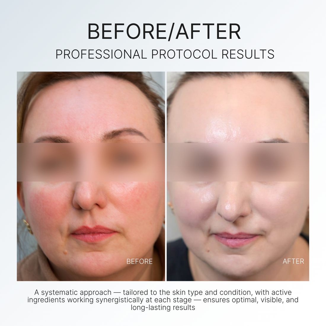 ROSACEA CONTROL